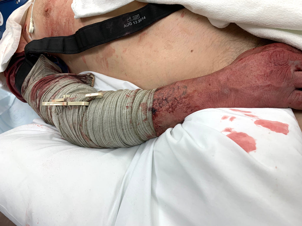 Module 1 - Hemorrhage Control